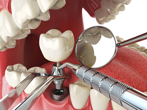 Best Urgent Dental Care  in March Ar, CA